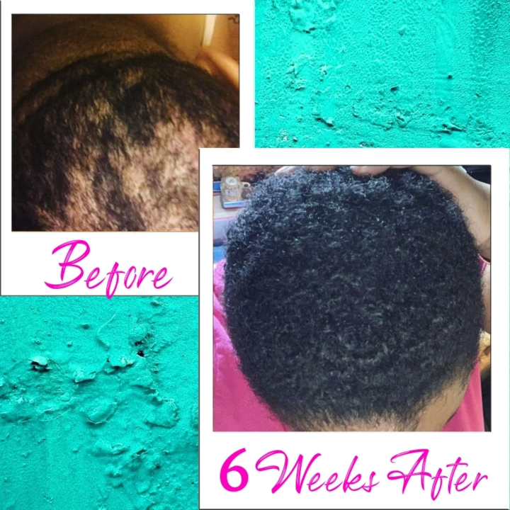 Natural Hair ReGrowth Serum